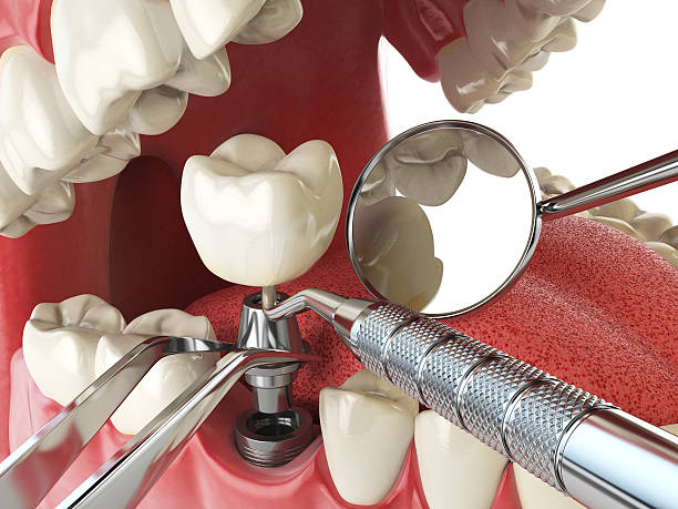 Best Emergency Treatment for Oral Infections in Magnolia, NJ
